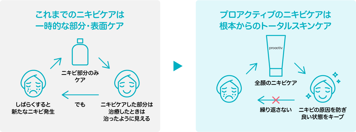プロアクティブのニキビケアは根本からのトータルスキンケア
